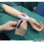 腕で&ldquo;育てた&rdquo;耳を頭部へ移植