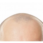 ロック様ら抑え&hellip;&ldquo;世界で最もセクシーな薄毛男性&rdquo;今年の1位は？