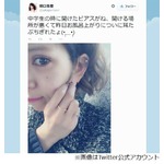 坂口杏里の耳たぶがちぎれる、公開された写真にファンから心配の声。