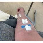 平野ノラ、点滴姿で治療報告「いつもなら酷くなるのに今回は一瞬の喉の痛みで済みました」