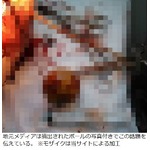 74歳が肛門にボール入れ大惨事、悩み続けた下痢を止めようと閃くも&hellip;。