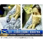 &ldquo;綺麗すぎる整形&rdquo;で殴られる、自身の手術に不満持つ女性の犯行か。