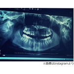 「衝撃の事実」菜々緒は出っ歯、ファンも「まさかの（笑）」と驚きの声。