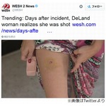 なんか痛い&hellip;5日後に撃たれてると判明、被害女性「バカに銃持たせるな」。