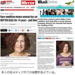 &ldquo;体から魚の腐臭&rdquo;に悩む女性、多くの人に認知して欲しいと勇気の告白。