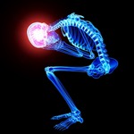 &ldquo;大便力みすぎ&rdquo;トイレで卒倒、脳動脈瘤が刺激されたことが原因。