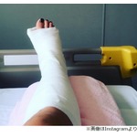 道端アンジェリカが転倒し骨折、手術へ