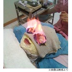火使う&ldquo;目もとエステ&rdquo;に衝撃、専門家からは「危険すぎる」の声。