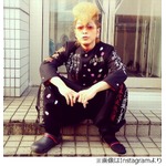 綾小路翔がじん帯損傷＆骨折、1月に判明もけが隠してツアーを敢行。