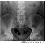 手術で&ldquo;健康な睾丸&rdquo;を誤摘出、「父親になれない」と病院を提訴。