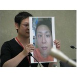 苦しみ訴えるレーシック難民「執刀医の医師免許取り消しなど罰則を」。