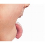 瓶の中に女児の舌ぴったんこ、医師も助けられず消防隊出動の騒ぎに。