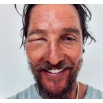  マシュー・マコノヒー、ハチに刺され目腫れ上がるも&ldquo;にっこり&rdquo;