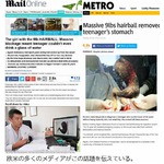 胃の中から4kgの巨大毛玉摘出、髪の毛やカーペットを食べ続けた少女。