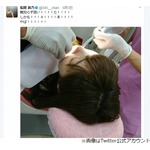 指原莉乃、多忙すぎて親知らず4本一気に抜く