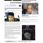 少年の目に大きなフック刺さる、肉屋で遊んでいたら羊吊り下げ用が&hellip;。