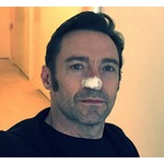 ヒュー・ジャックマン、新たながん発見