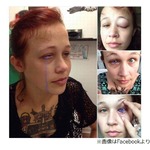 &ldquo;目にタトゥー&rdquo;が失敗、紫色の涙流し後悔