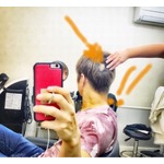 GACKTが2度目の円形脱毛症を告白