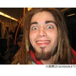 &ldquo;自分の肉&rdquo;食べてみた芸術家、手術で取り除いた骨についた肉試食。