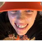 ビリー・アイリッシュ&ldquo;歯にダイヤ&rdquo;披露も「とてつもなくバカっぽく見える」の声