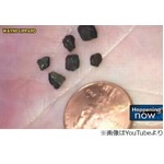 男の子の頭に&ldquo;隕石&rdquo;直撃か、詳細な分析が必要も父親は確信。