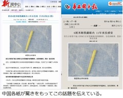 眼の違和感は6cmの箸だった、転倒時に先端刺さるも11年間気付かず。