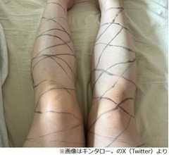 「網タイツがない、そうだ!」キンタロー。が閃いた結果…SNSで“注意喚起”