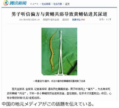 “お魚セラピー”で尿道に突入、ツルツルのタウナギがスルッと体内へ。