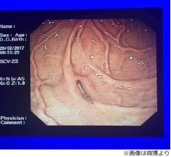 病に効く？ イノシシから生きた寄生虫食べ散々