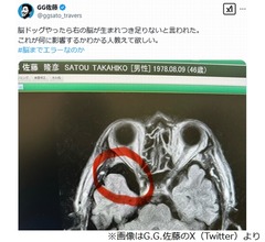 “五輪で痛恨落球”G.G.佐藤氏、脳が生まれつき足りなかった…「脳までエラーなのか」