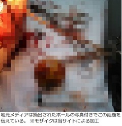 74歳が肛門にボール入れ大惨事、悩み続けた下痢を止めようと閃くも…。