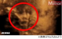 胎内写真に“祖母の顔”写る? 「娘を見守ってくれる守護天使だ」。