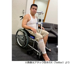 ジェラードン・アタック西本、悲しげな“車イス姿”に心配の声