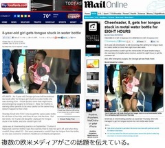 水筒に少女の舌詰まり抜けず、病院搬送後に体調悪化で手術するハメに。