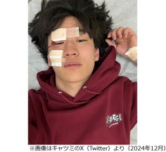 ピン芸人のキャツミ、警察に「よく生きてたなぁ」と言われた交通事故振り返る