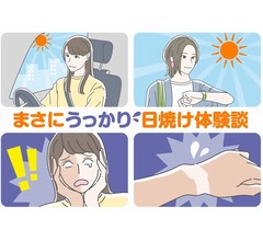 “うっかり日焼け”体験談が続々「時計を外したら…」「車の運転で右側だけ…」