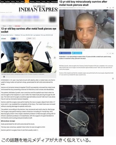 少年の目に大きなフック刺さる、肉屋で遊んでいたら羊吊り下げ用が…。