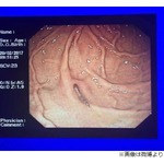 病に効く？ イノシシから生きた寄生虫食べ散々