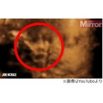 胎内写真に“祖母の顔”写る？ 「娘を見守ってくれる守護天使だ」。