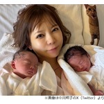 中川翔子、無事に双子出産「母子共に健康です！2人とも2600g越え！」