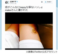 広瀬すず　太もも 広瀬すず&ldquo;太もも&rdquo;写真が話題、ニコニコ顔のあざに「かわいい！」。 | ハッピーニュース
