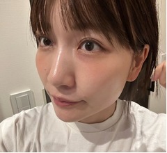あいのり桃、3回目の「二重埋没手術」から1か月たった顔を公開