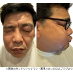 上白石萌歌、“サンド富澤の顔パンパン”副鼻腔炎に「実は私もなったことがありまして」