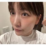 あいのり桃、3回目の「二重埋没手術」から1か月たった顔を公開